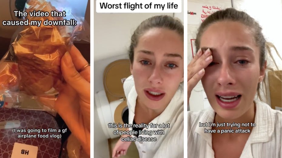 25-årige Chloë Chapdelaine fik galopperende diarré, efter hun satte sine tænder i en glutenfyldt croissant under en 15 timer lang flyvetur.