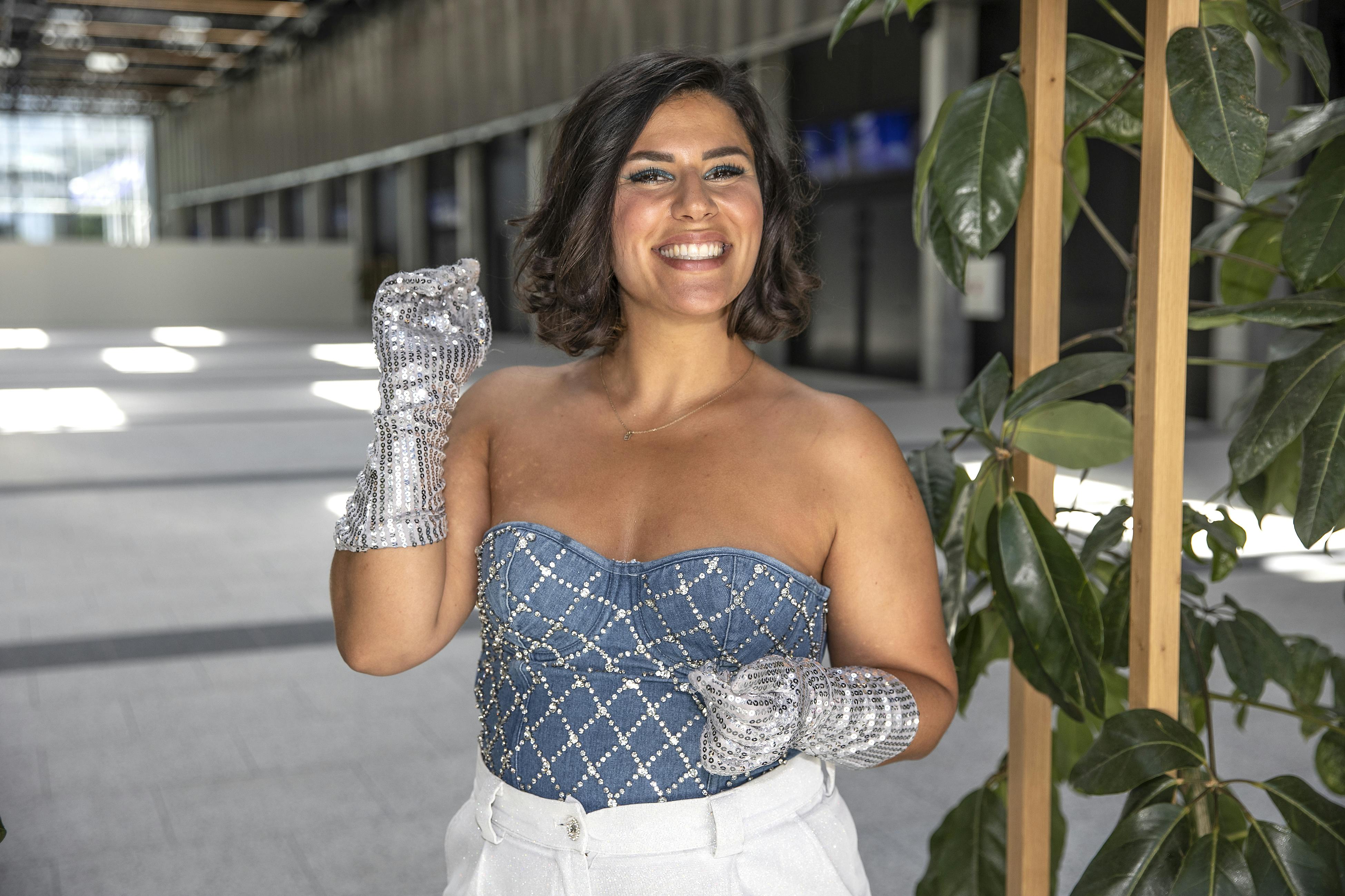 Altid storsmilende Jasmin Gabay fik for nylig fikset fortrinene - og hun er yderst begejstret for resultatet.&nbsp;