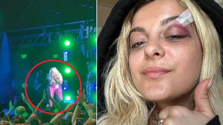 Til venstre bliver Bebe Rexha ramt af en mobiltelefon på scenen, og til højre viser hun resultatet frem.