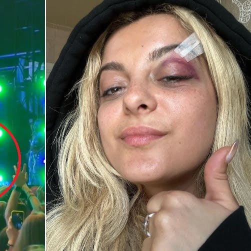 Til venstre bliver Bebe Rexha ramt af en mobiltelefon på scenen, og til højre viser hun resultatet frem.