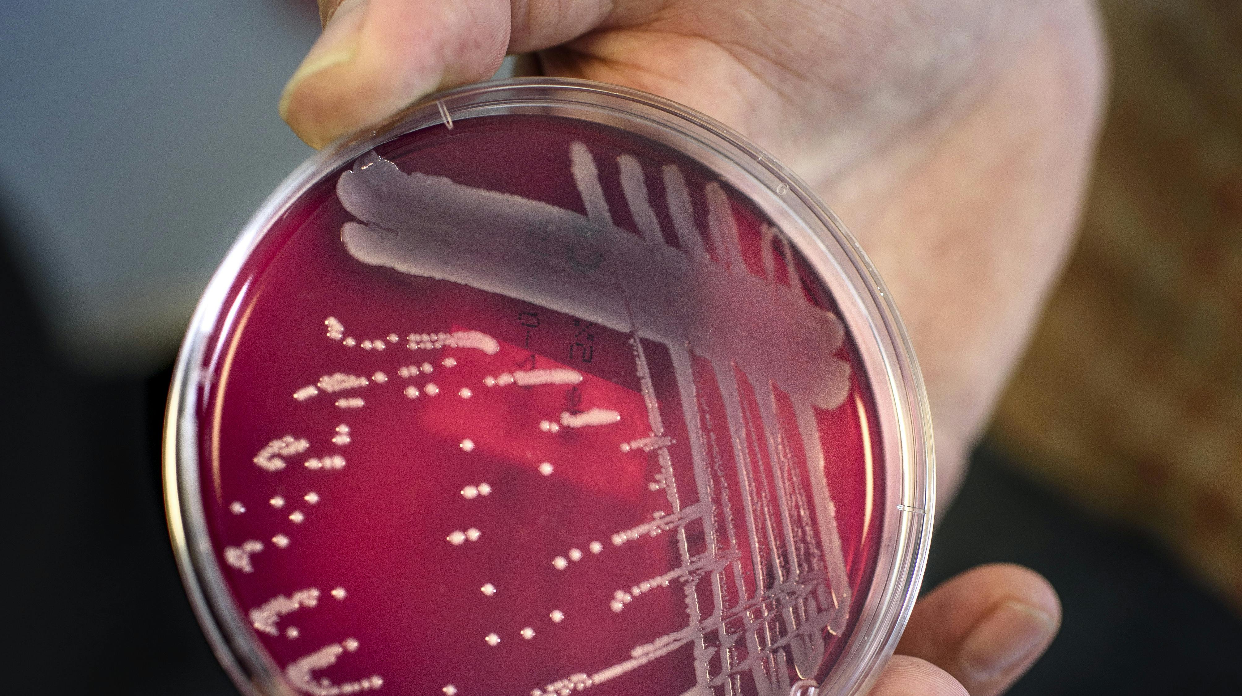 En ny variant af streptokokbakterier ramte Danmark hårdt den forgangne vinter.
