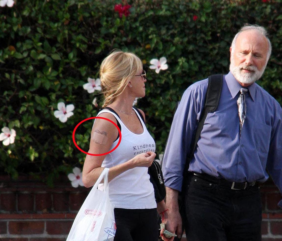 I 10 år har Melanie Griffith arbejdet på at få tatoveringen af eks-manden væk. Nu er det lykkedes.