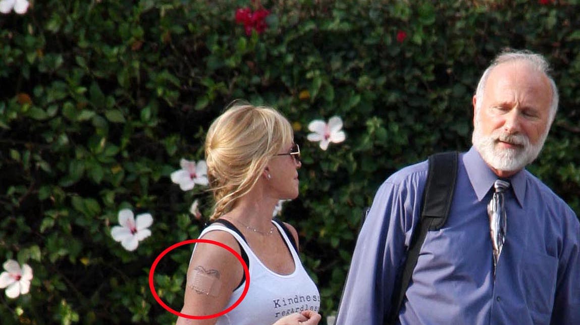 I 10 år har Melanie Griffith arbejdet på at få tatoveringen af eks-manden væk. Nu er det lykkedes.