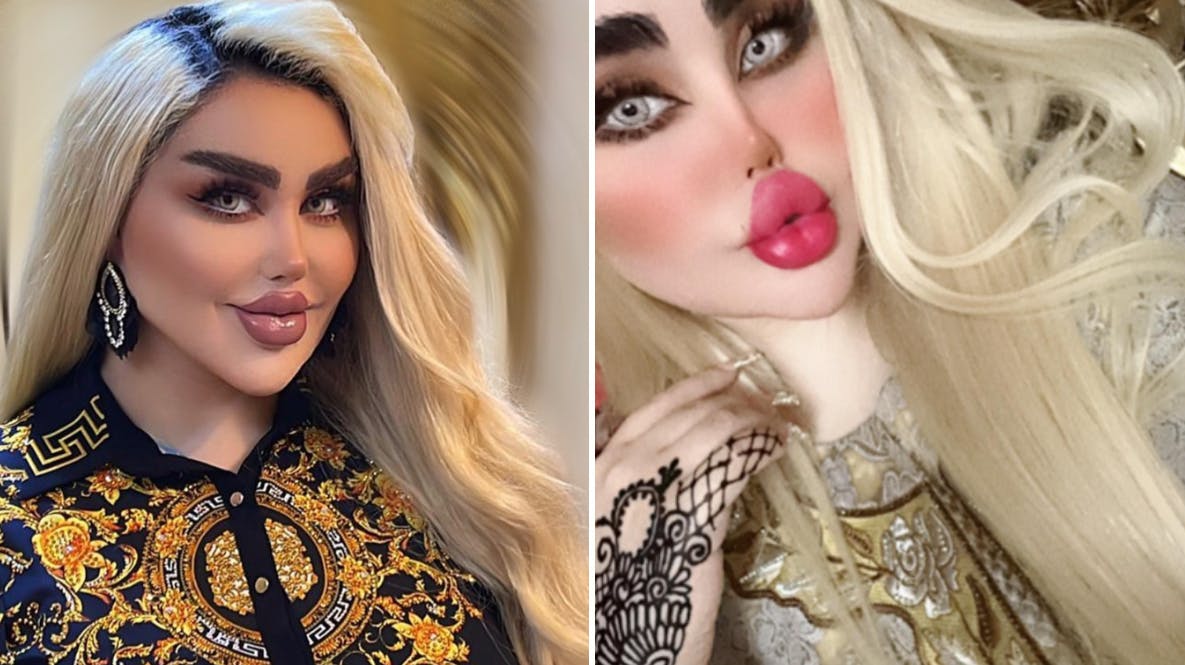 Dalia drømmer om at ligne en Barbie-dukke. 