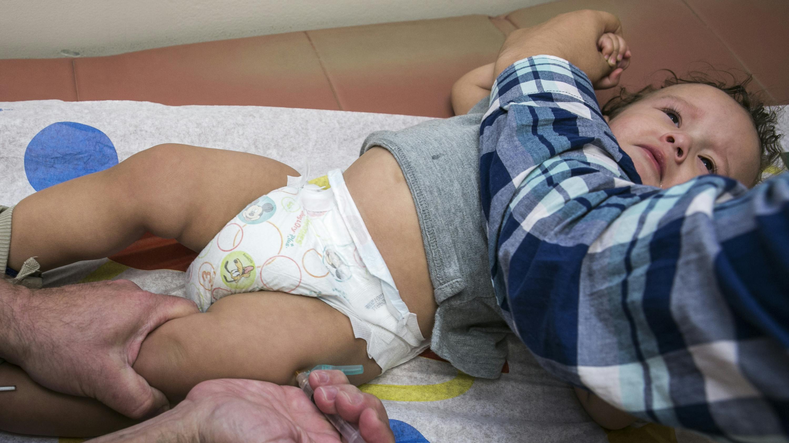 To danske børn er blevet smittet med mæslinger efter en udenlandsrejse.