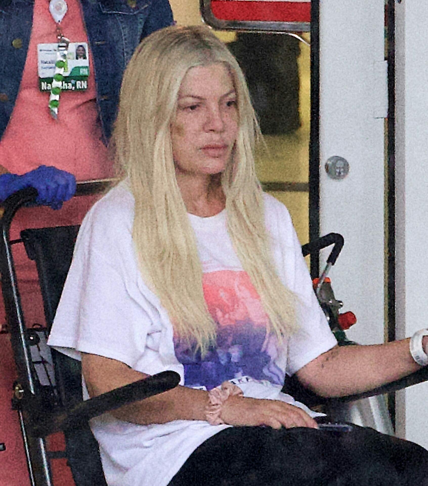 Tori Spelling forlader hospitalet med tydelige blå mærker i ansigtet og på begge arme. Men hvad er der dog sket?