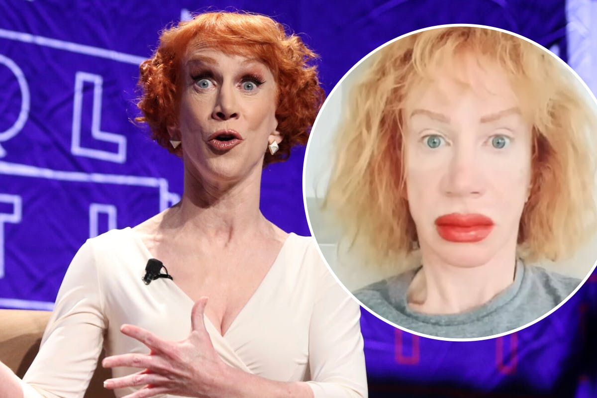 Kathy Griffin kan bestemt godt se humoren ved sin seneste ansigtsbehandling.