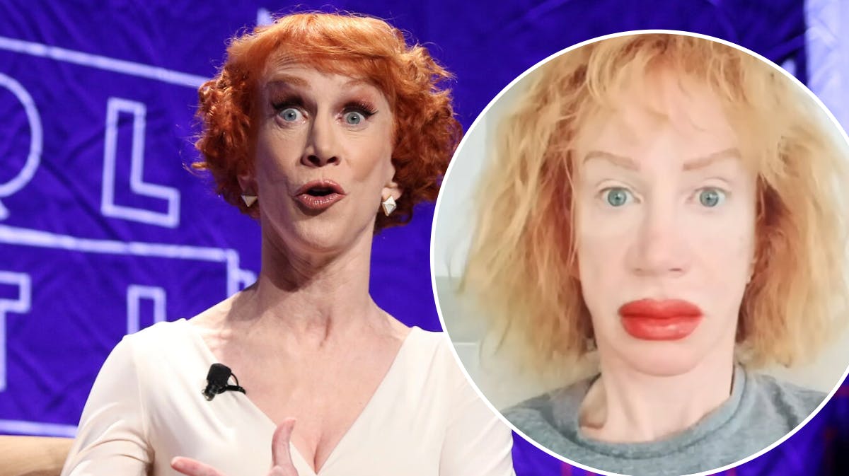 Kathy Griffin kan bestemt godt se humoren ved sin seneste ansigtsbehandling.