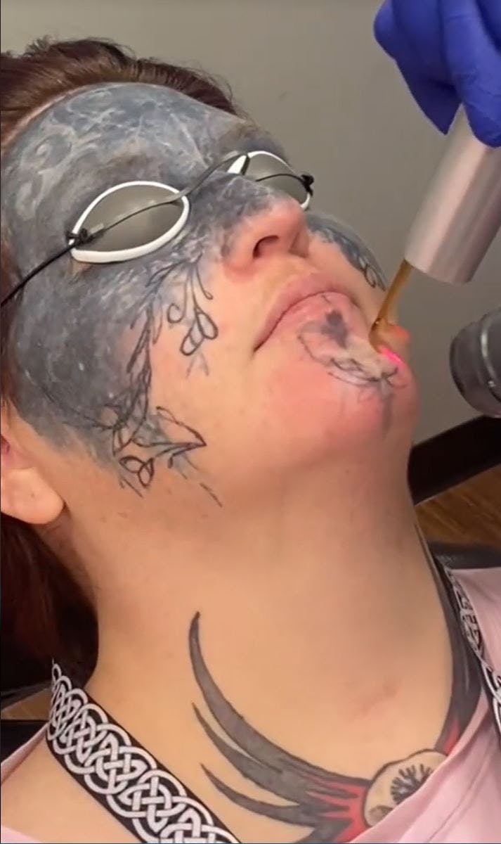 TikTok'eren Thedadbot deler Taylors rejse mod et normalt liv.