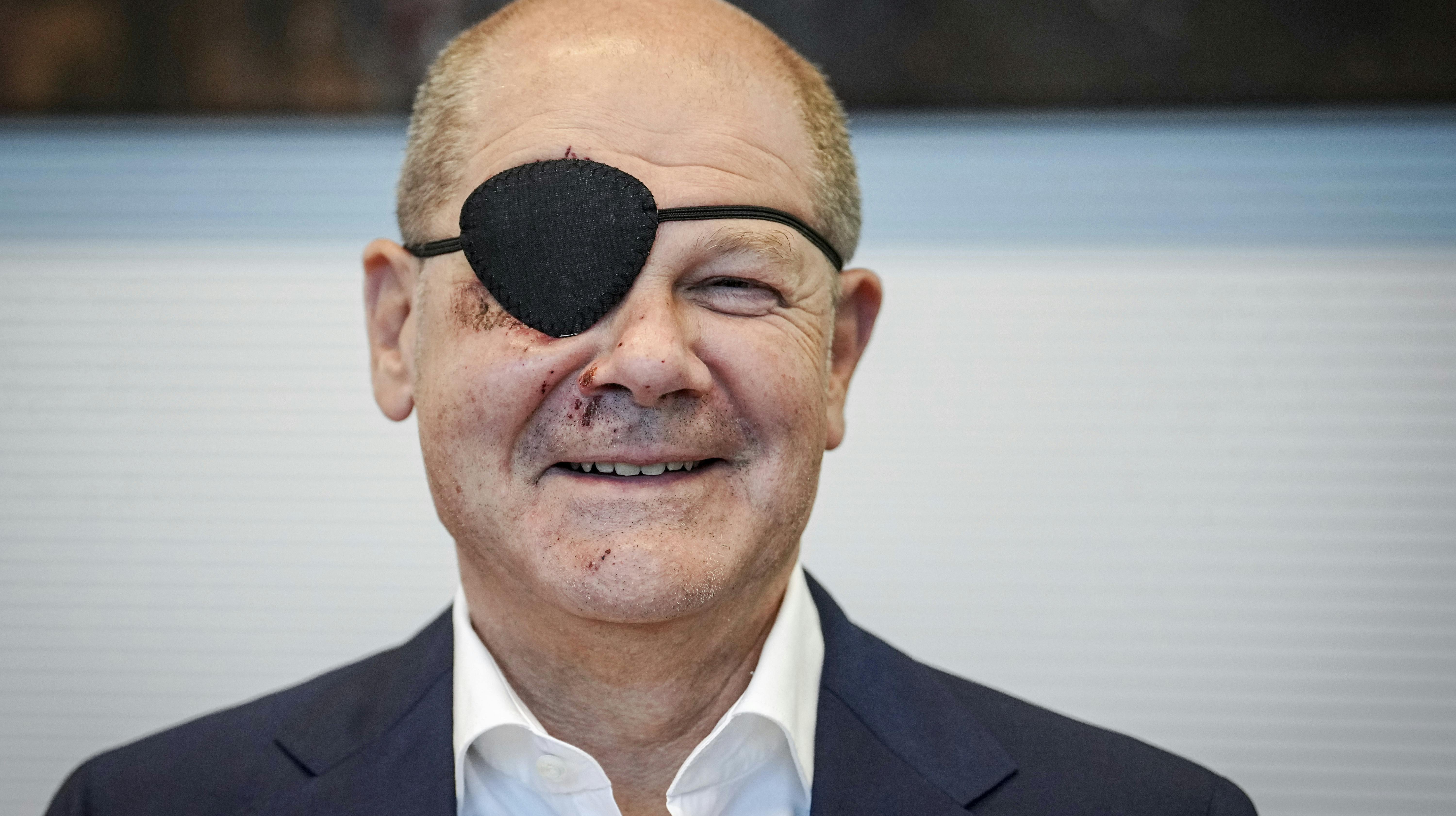 Den tyske forbundskansler, Olaf Scholz, med klap for øjet efter et fald under en løbetur.