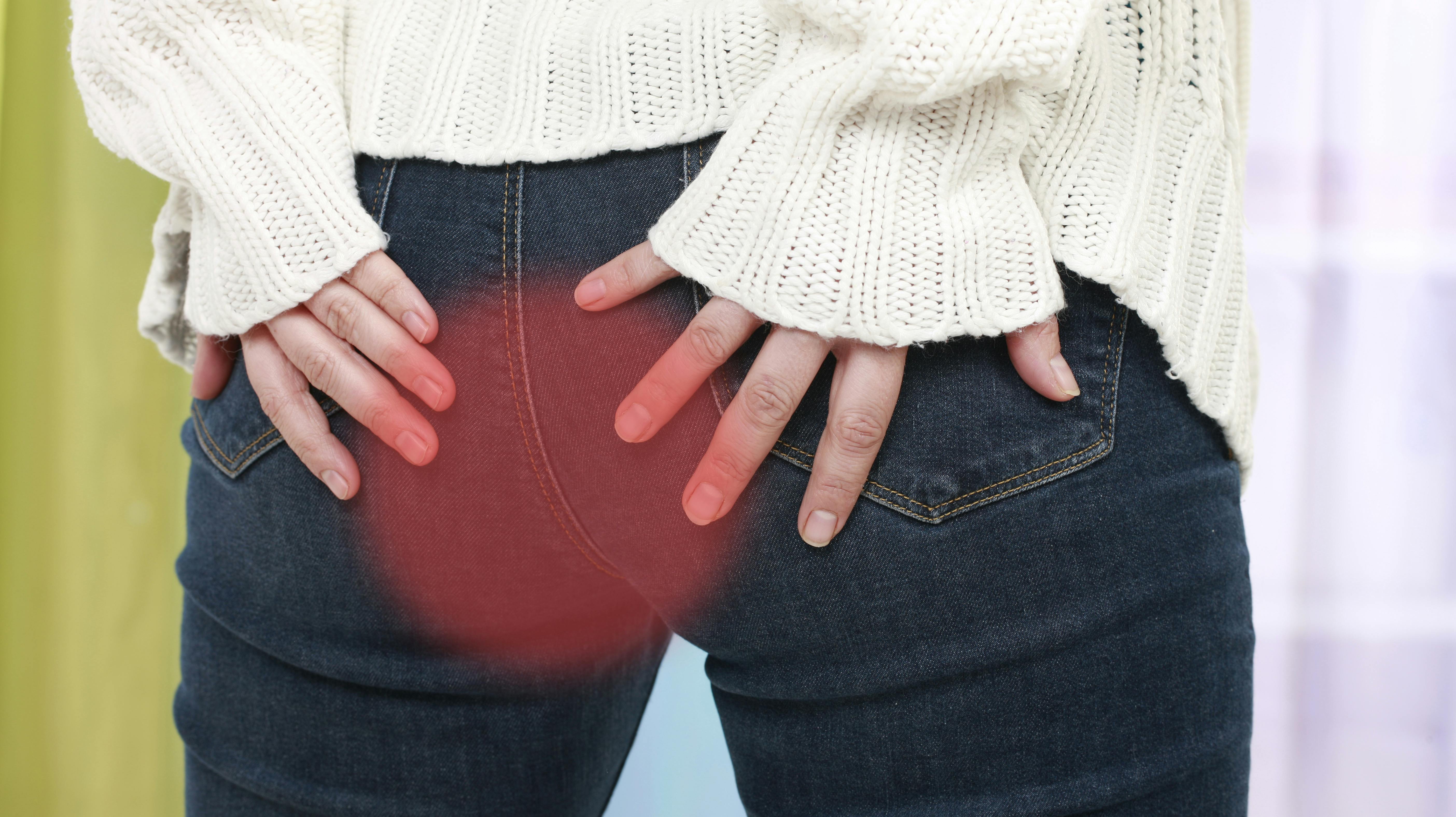 Woman with anal pain and haemorrhoids