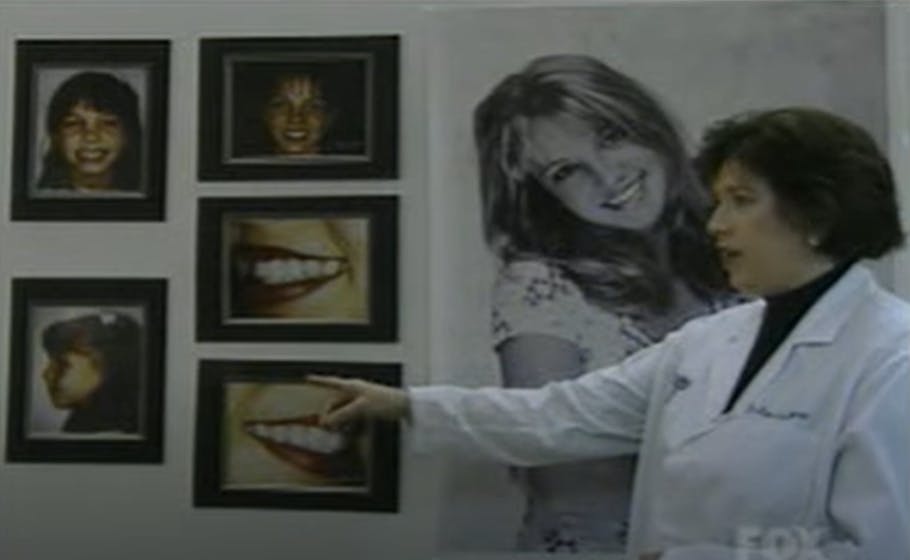 Britneys tandlæge viser popstjernens tandkorrigeringsproces frem. 