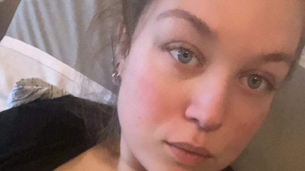 Mette Filt beskrev under videokonsultationen flere symptomer på en blodprop, men vagtlægen rådede hende til at tage smertestillende og kontakte egen læge. 