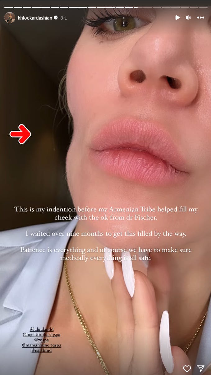 https://imgix.seoghoer.dk/2023-09-20/khloe-2.png