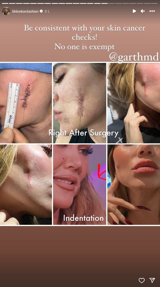 https://imgix.seoghoer.dk/2023-09-20/khloe-3.png
