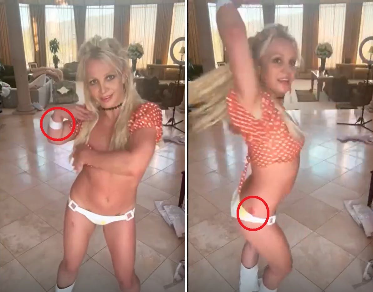 Britney Spears har mystiske mærker rundt omkring på kroppen efter bizar knivedans.