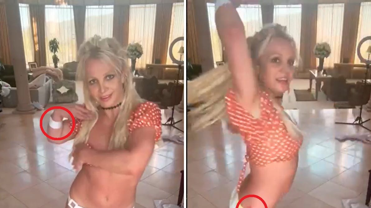 Britney Spears har mystiske mærker rundt omkring på kroppen efter bizar knivedans.