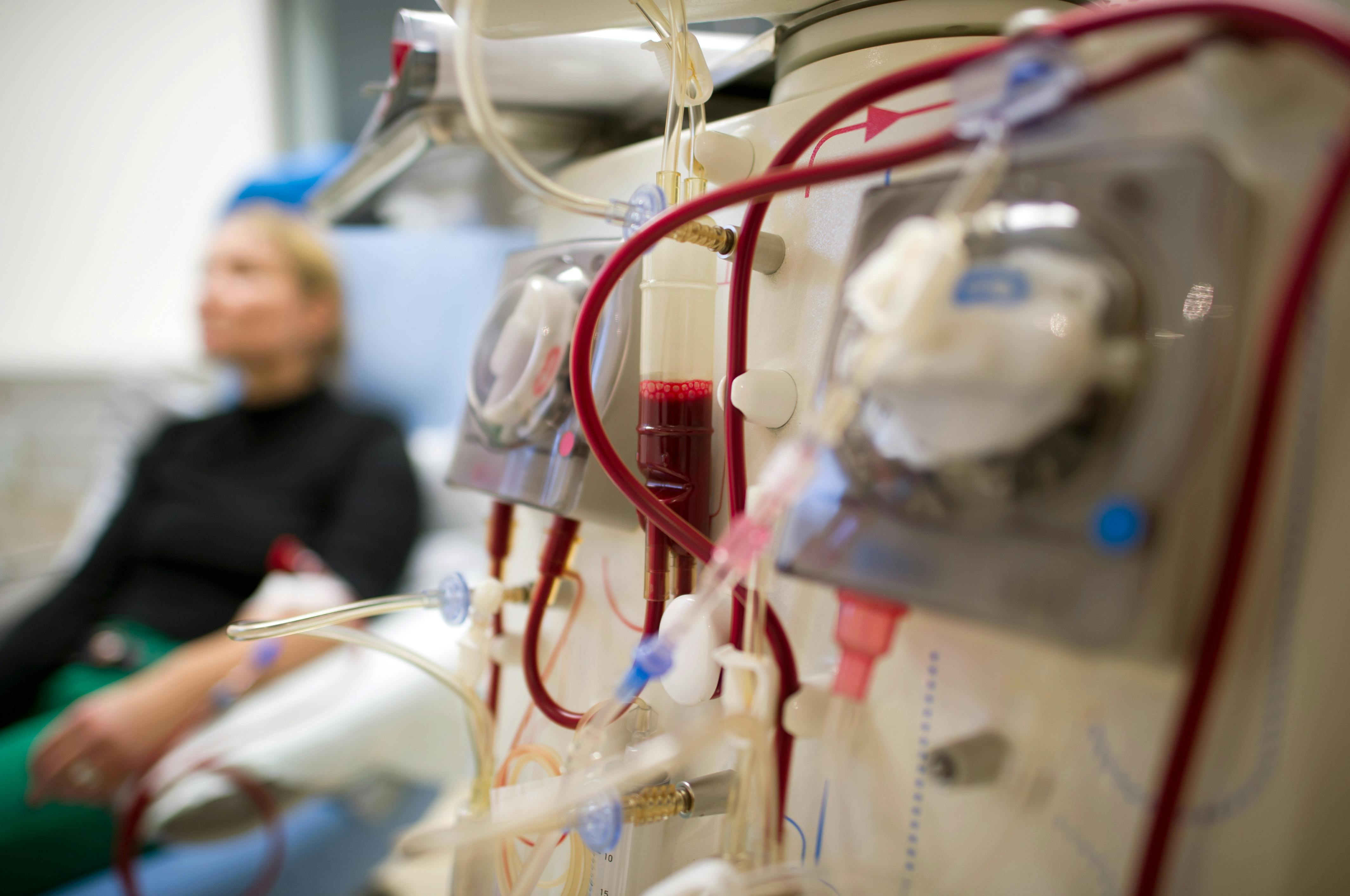 Fra 1. november må dialysepatienter på sygehuset i Thisted fryse eller tage deres egne dyner eller tæpper med. 