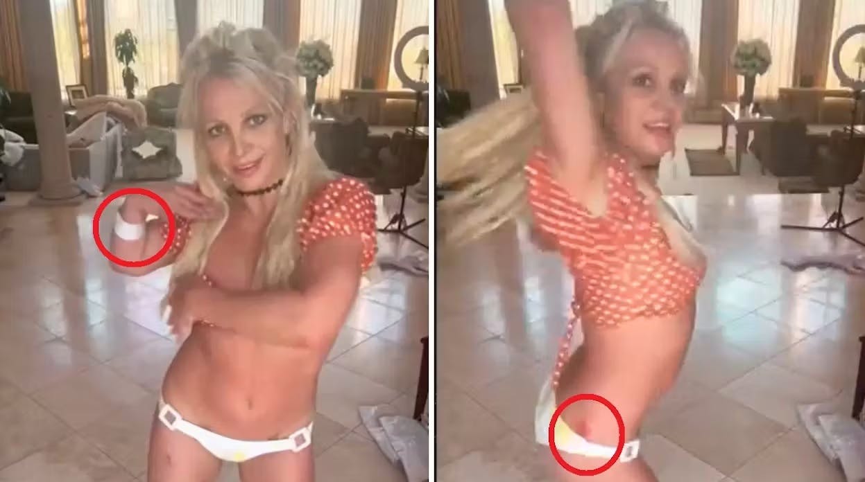 Sådan så Britney Spears' krop ud dagen efter danseriet med knivene.