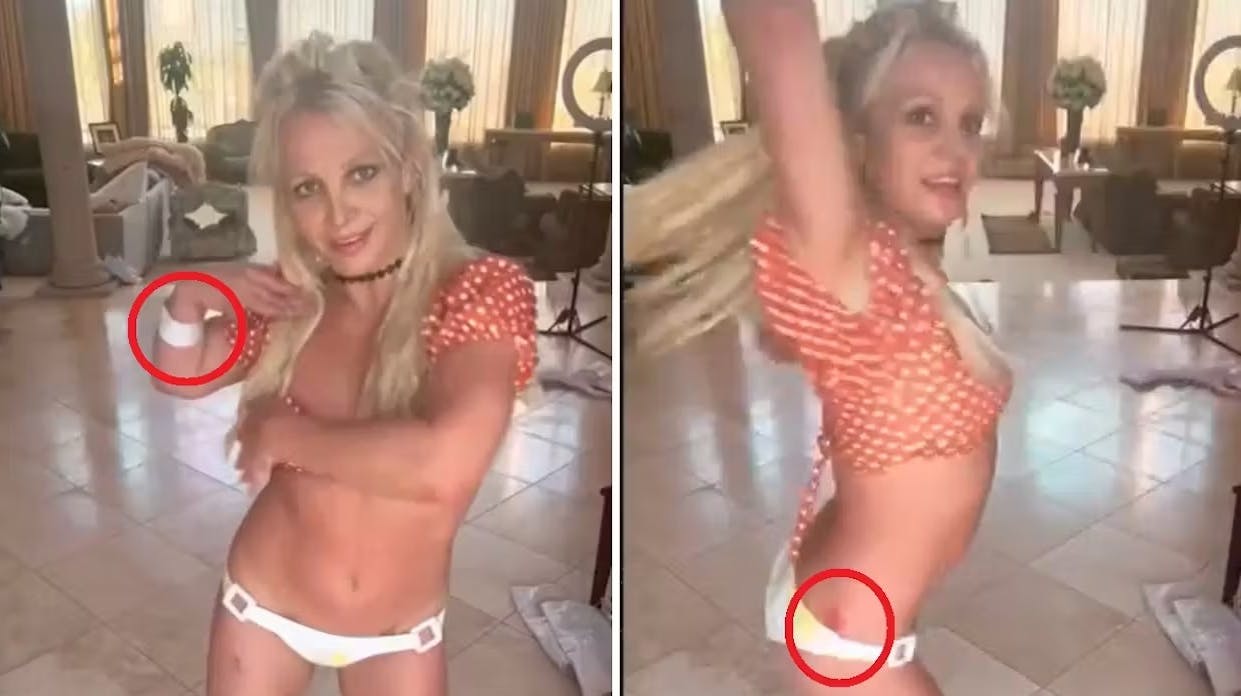 Sådan så Britney Spears' krop ud dagen efter danseriet med knivene.