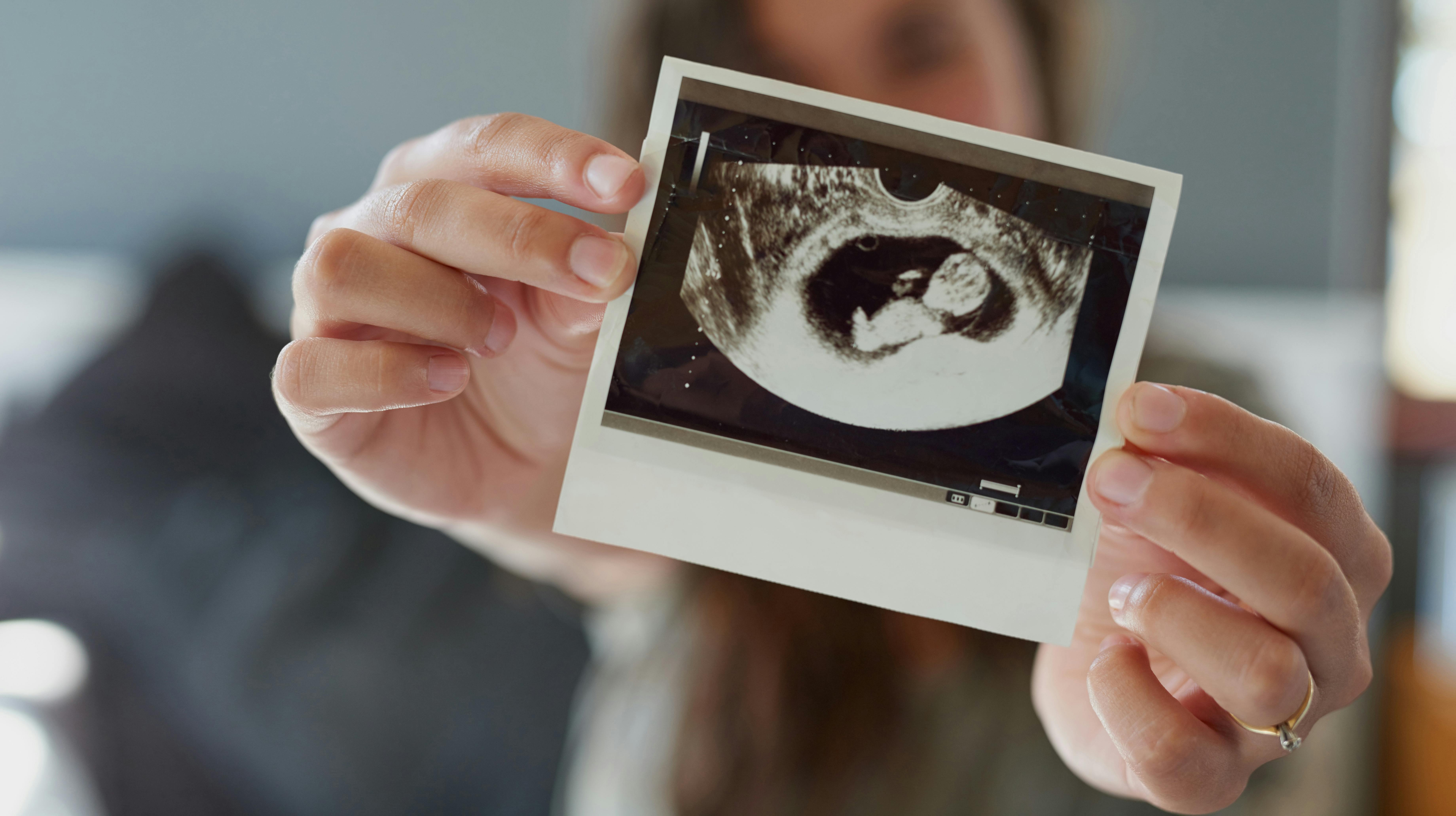 Er du gravid, bør du lade dig vaccinere mod kighoste.