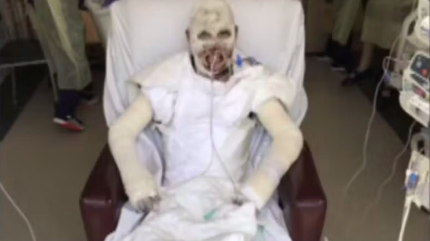 Den 9. december 2019 befandt Jake Milbank sig på newzealandske ø White Island, da en vulkan pludseligt gik i udbrud. Han endte med gruopvækkende skader.