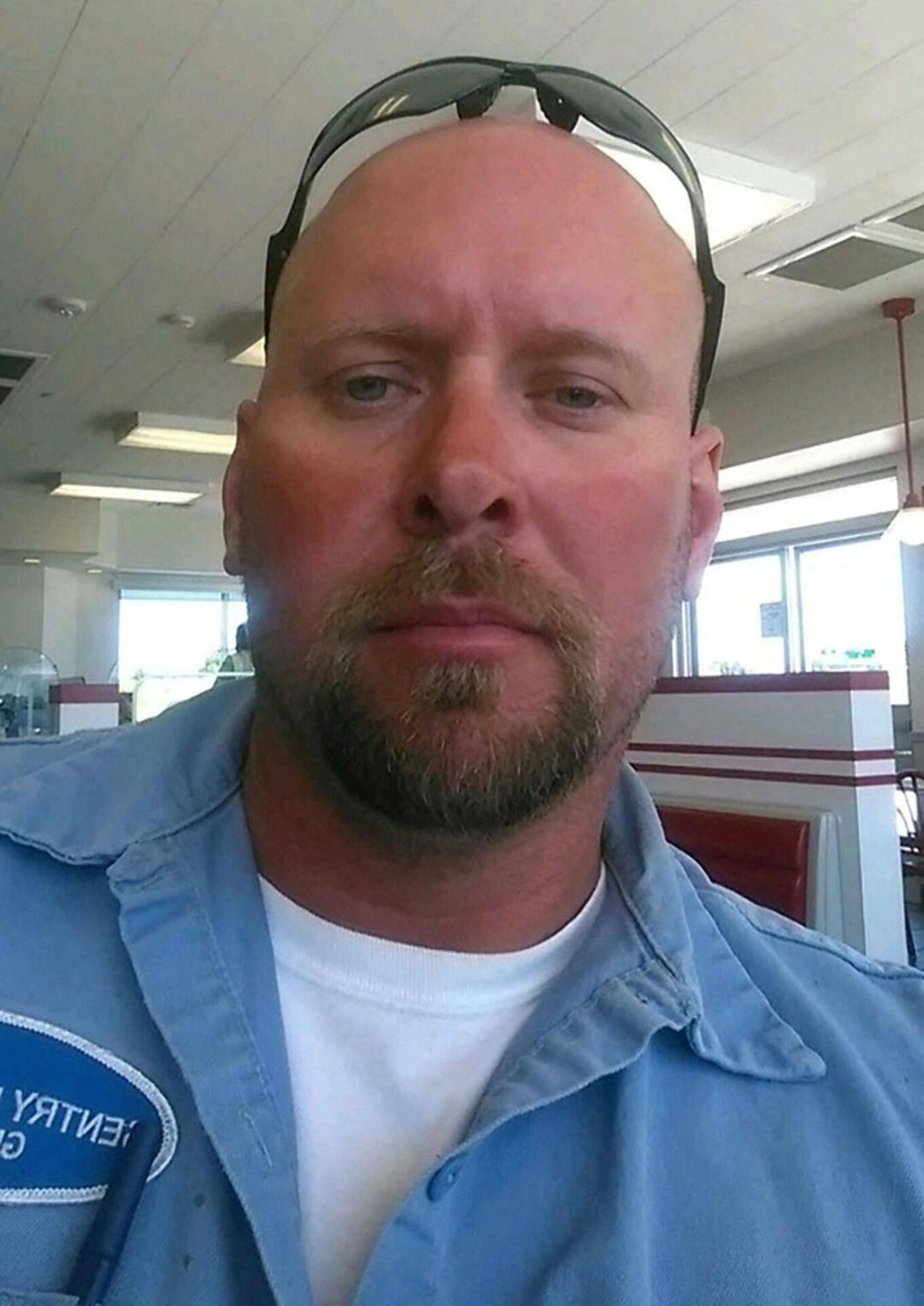 Aaron James mistede halvdelen af sit ansigt, da han fik en voldsom mængde strøm gennem sig.