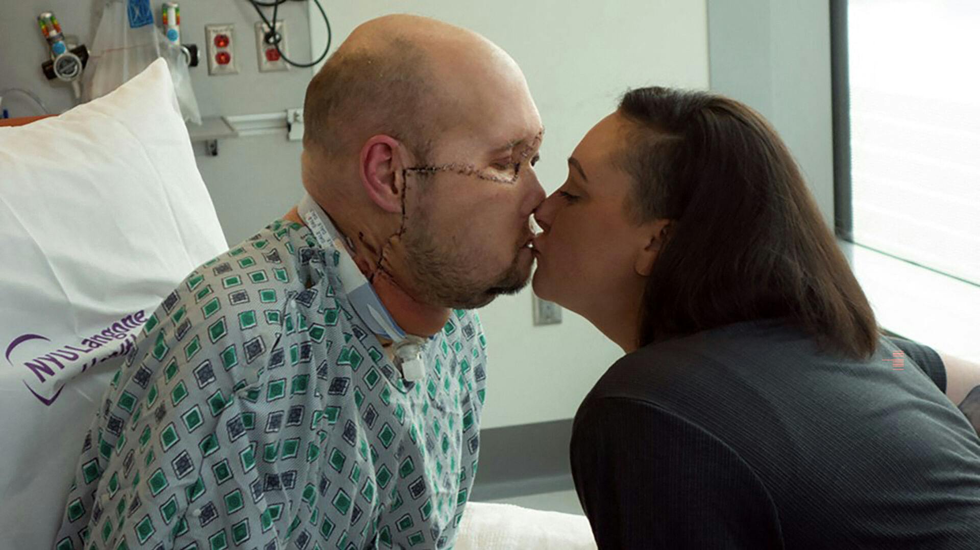 Aaron James kysser sin hustru Meagan efter operationen, der fandt sted på NYU Langone Health i New York.