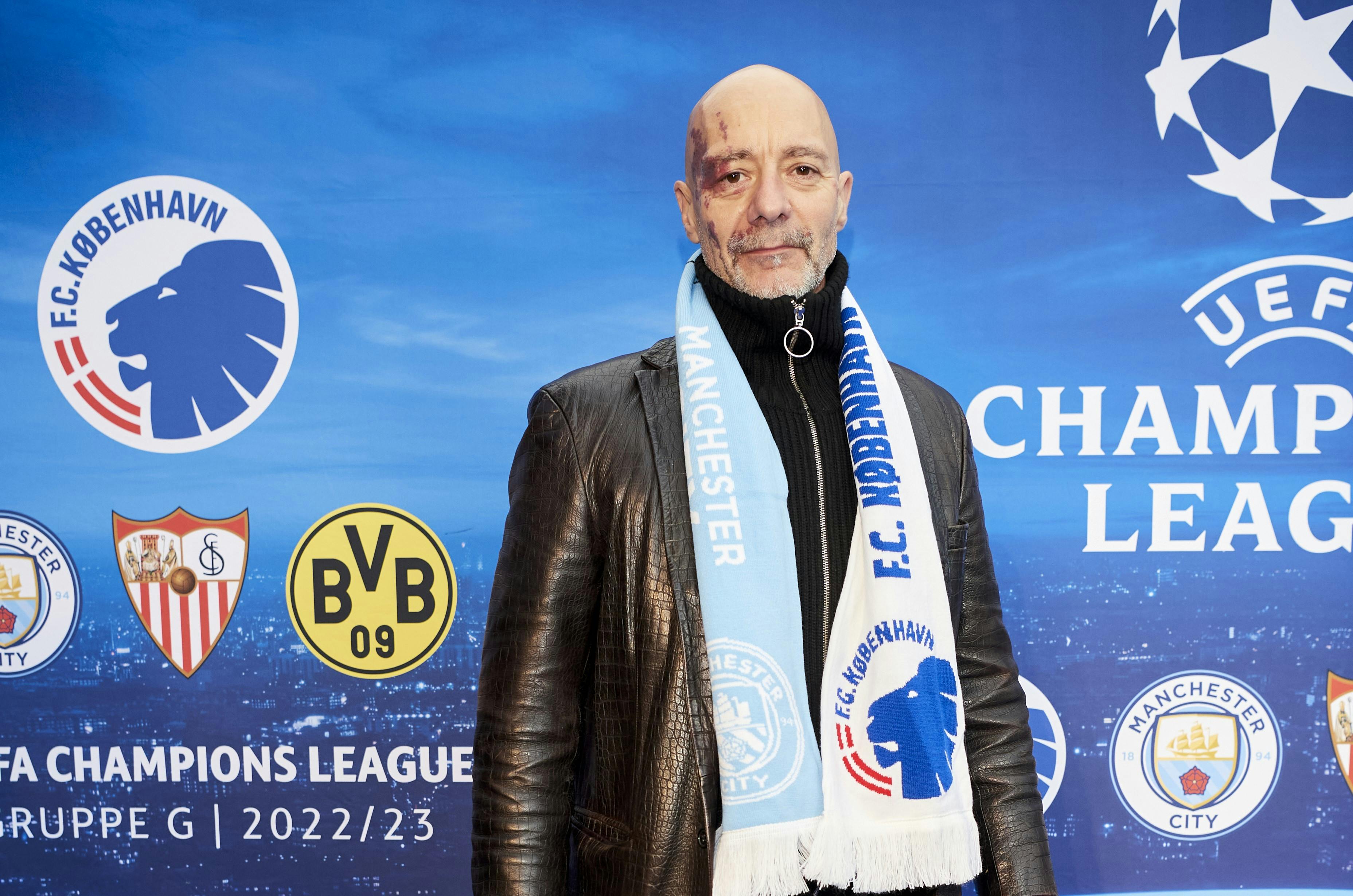 Jimmy Jørgensens opvækst har ikke altid været nem. Nu fortæller han, hvordan han som barn blev tæsket af sin mor.