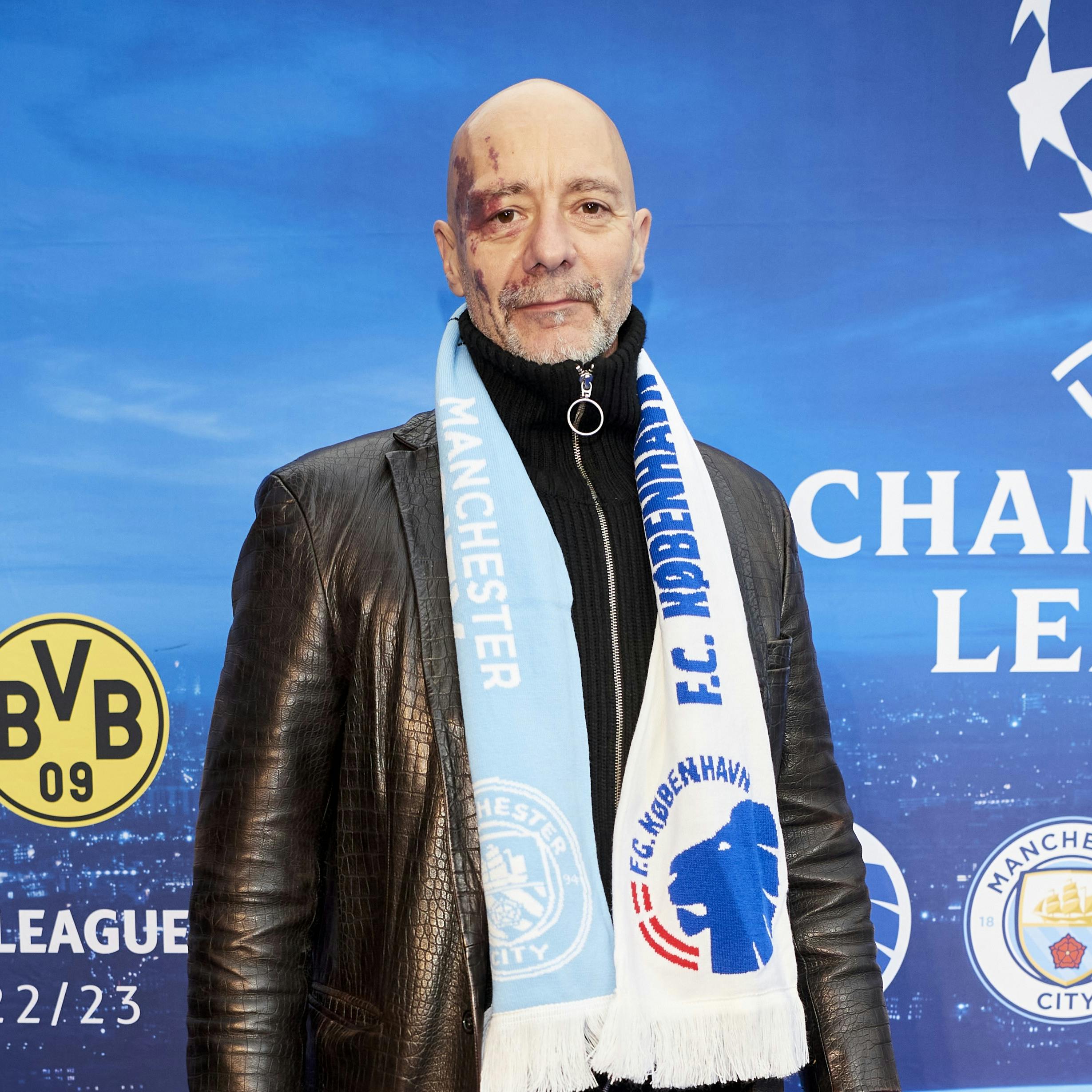 Jimmy Jørgensens opvækst har ikke altid været nem. Nu fortæller han, hvordan han som barn blev tæsket af sin mor.