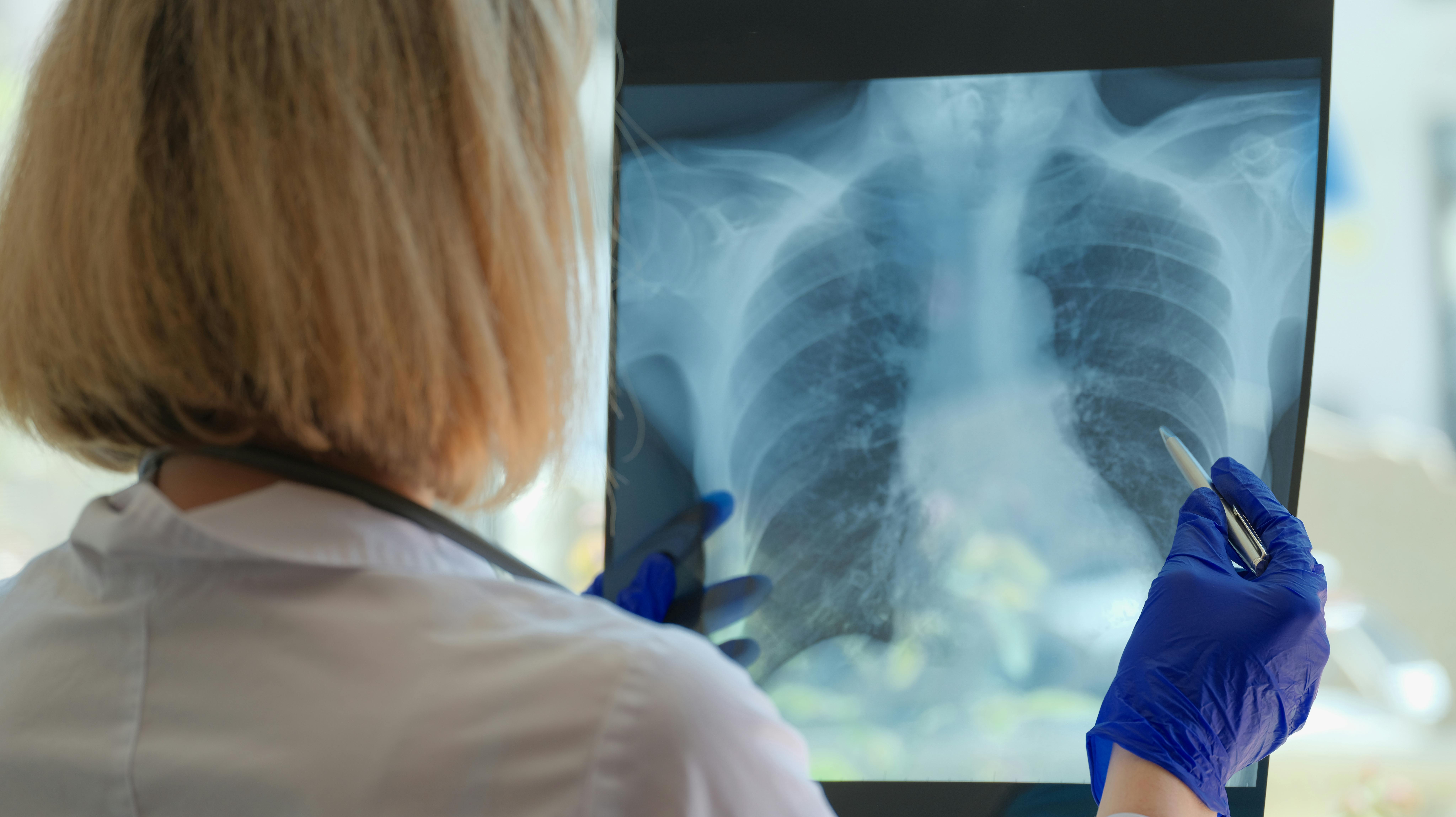 Forsikringsselskabet Dansk Sundhedssikring sendte 1. januar et nyt produkt på gaden, som giver kunder mulighed for at købe en cancerforsikring.