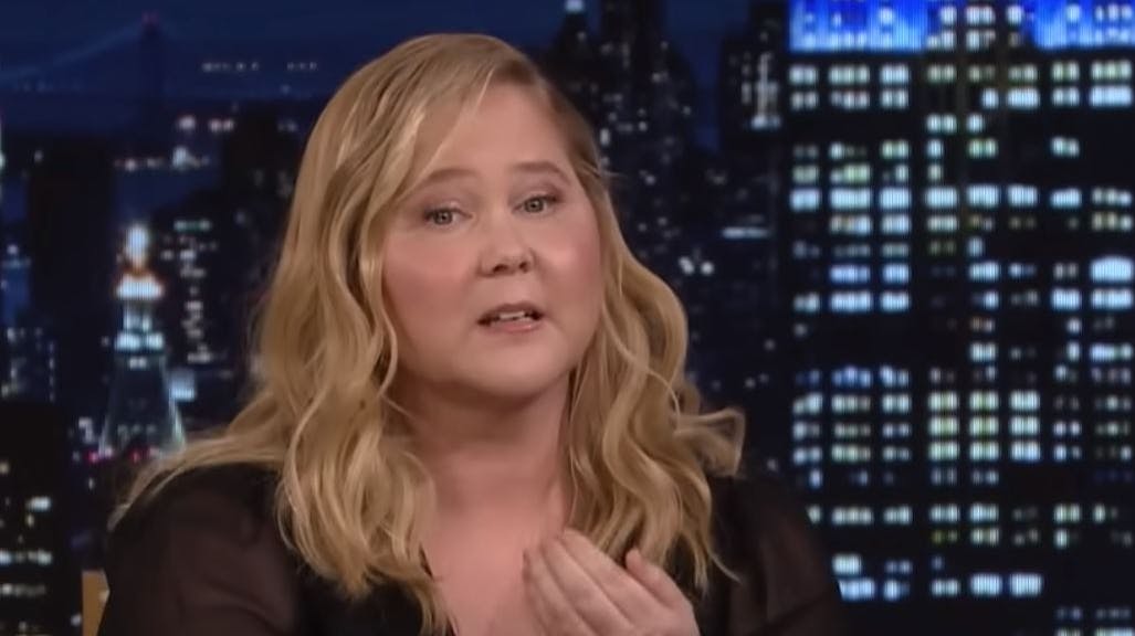 - Mange tak for jeres meninger, skriver Amy Schumer om reaktionerne på hendes udseende 