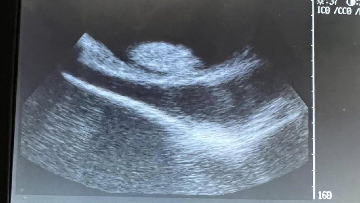 Et ultralydsscanning har bekræftet, at rokken Charlotte er gravid. Og det undrer mange, da hun ikke har været sammen med en artsfælle i otte år.