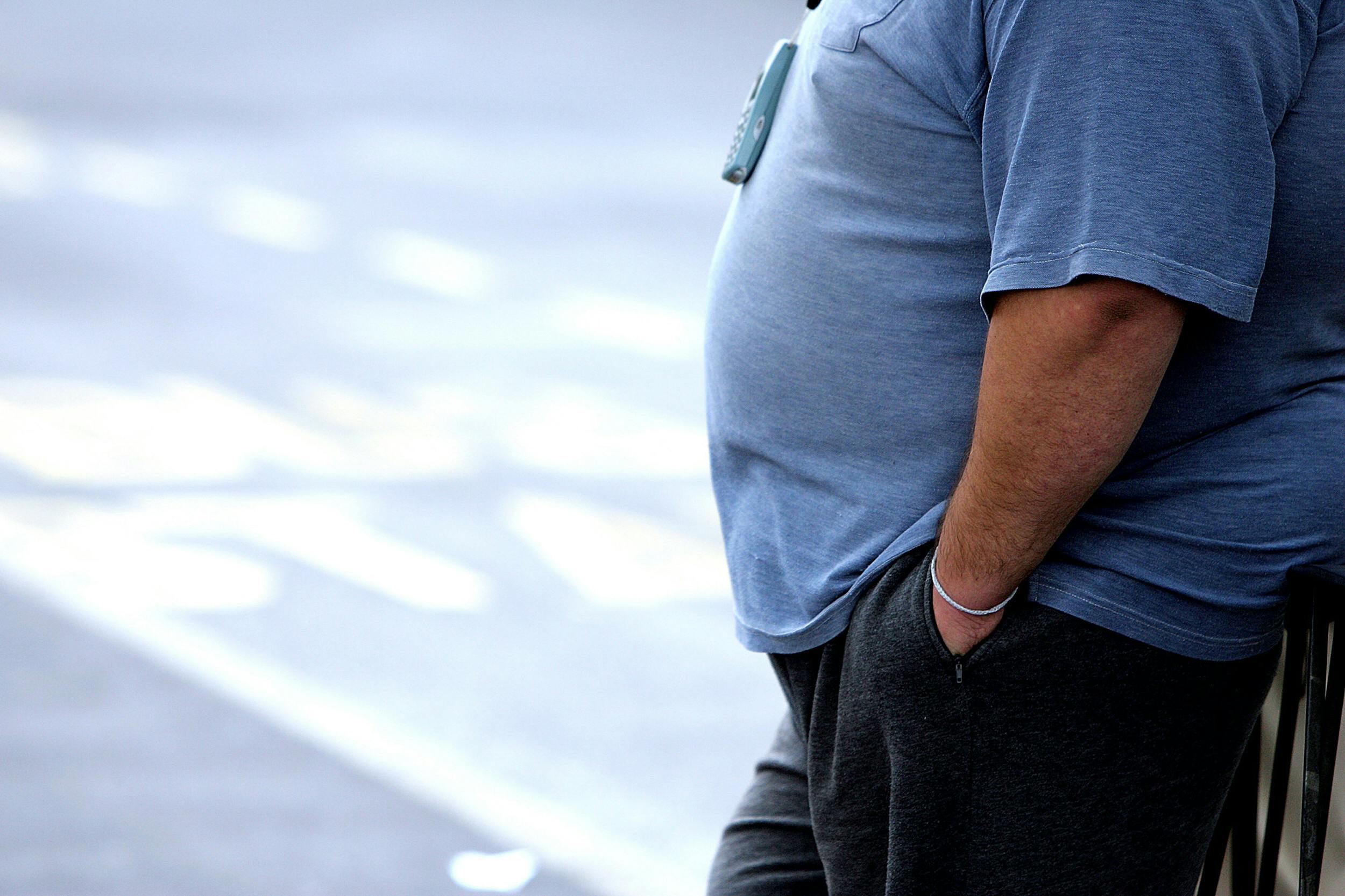 Tedros Adhanom Ghebreyesus, WHO's generalsekretær, opfordrer til øget samarbejde med den private sektor for at stoppe udbredelsen af svær overvægt. (Arkivfoto). 