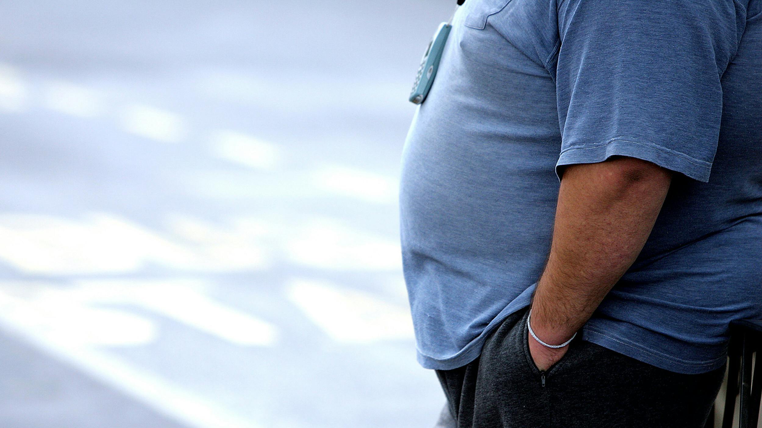 Tedros Adhanom Ghebreyesus, WHO's generalsekretær, opfordrer til øget samarbejde med den private sektor for at stoppe udbredelsen af svær overvægt. (Arkivfoto). 