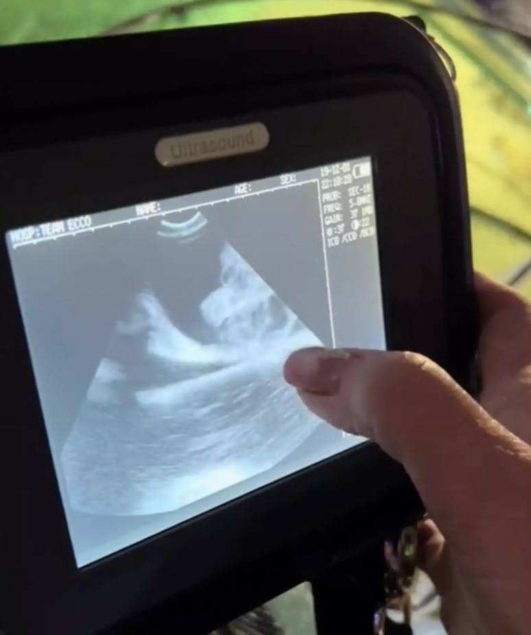 Ultralydsbilleder viser, at Charlotte ER gravid, men ingen forstår altså hvordan det er sket.