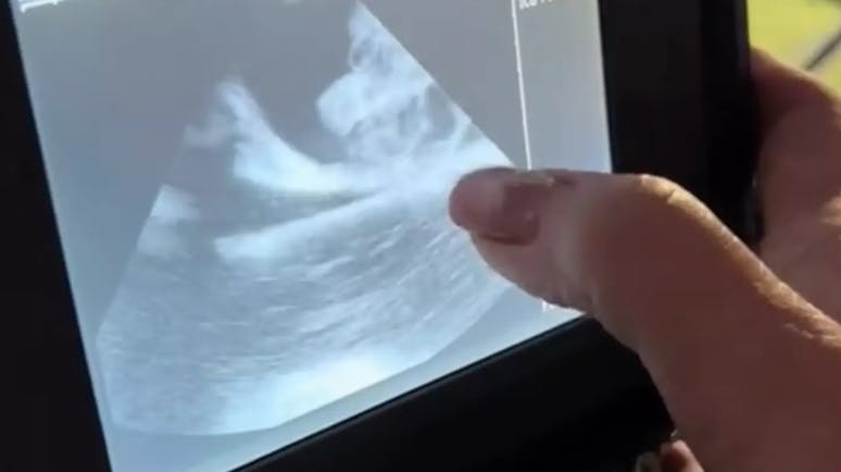 Ultralydsbilleder viser, at Charlotte ER gravid, men ingen forstår altså hvordan det er sket.