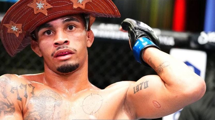 Andre Lima viser bidemærket frem. Han fik det efterfølgende tatoveret. 