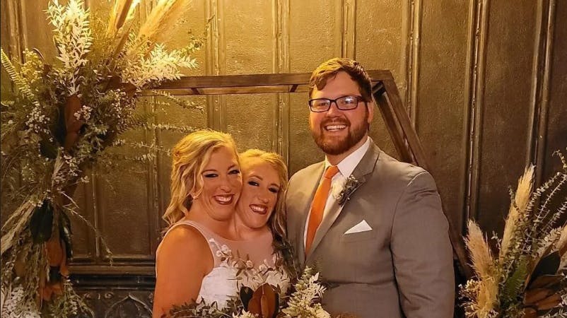 Abby Hensel med sit livs kærlighed – 33-årige Josh Bowling, der er krigsveteran. 