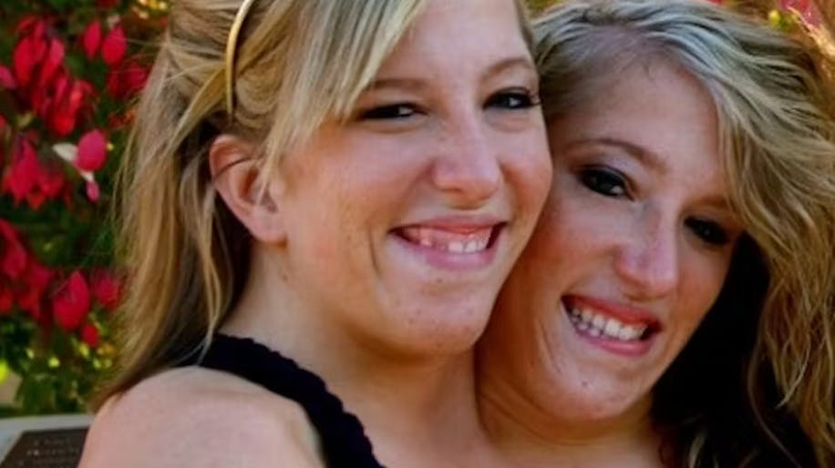 Amerikanske Abigail ”Abby” og Brittany Hensel er siamesiske tvillinger, men det afholder dog ikke de to søstre fra at leve livet.