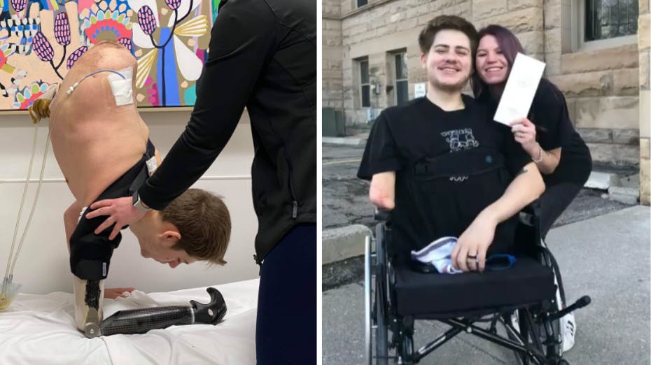 Loren Schauers et sandt mirakel, for han overlevede at få en fire tons tung gaffeltruck ned over sig. I dag kæmper han dog med noget andet: Nemlig at få venner. 