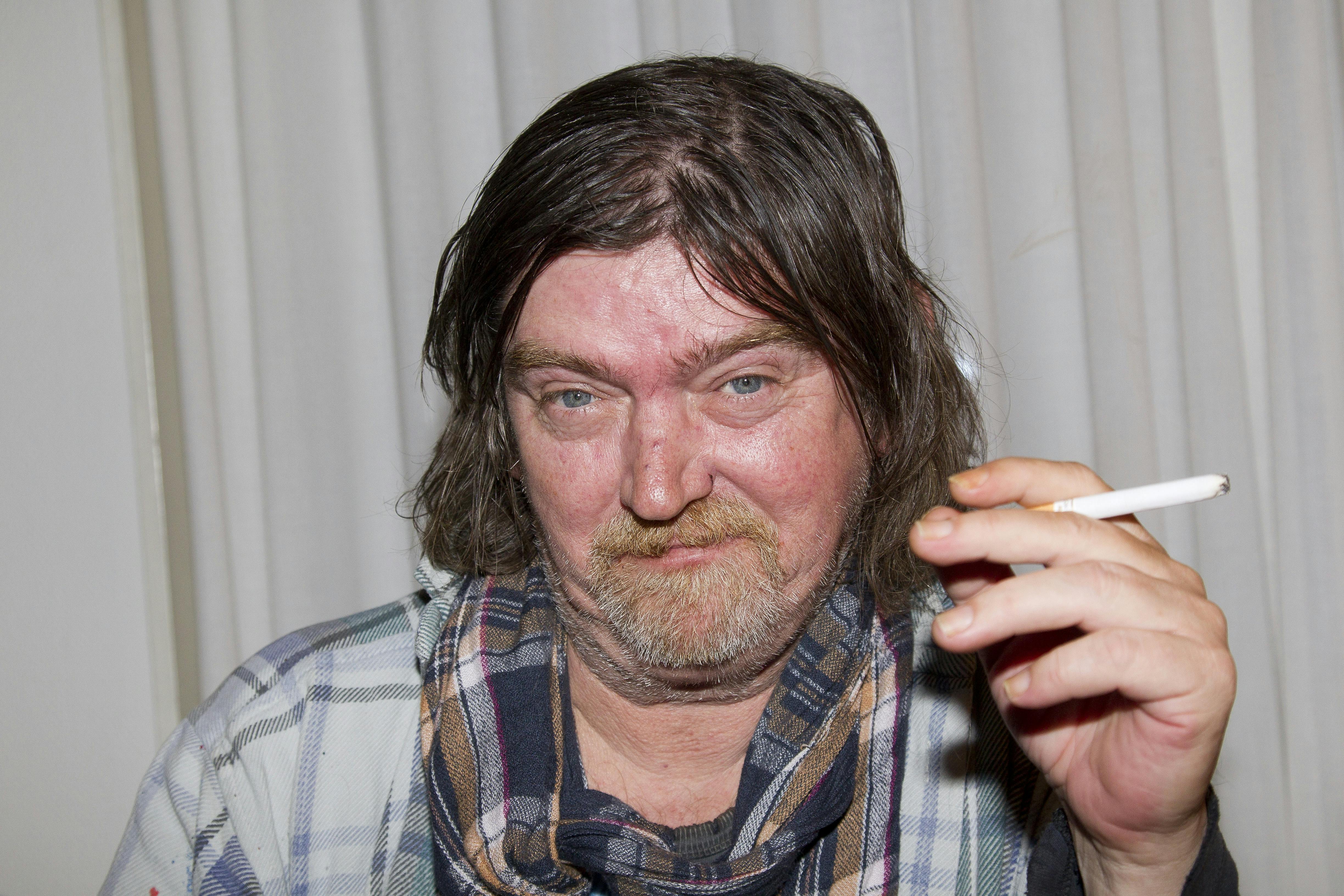 Johnny Madsen faldt over noget, da han var på vej i seng.