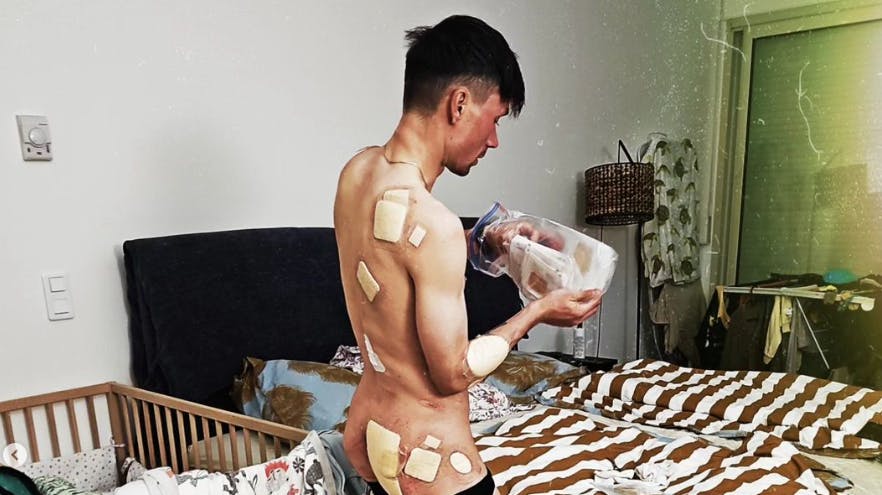 Cykelstjernen Primoz Roglic var indblandet i torsdagens uhyggelige styrt i Baskerlandet Rundt.