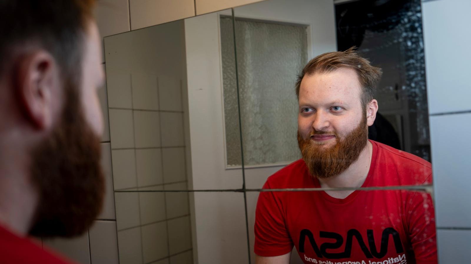 Selv om Rasmus Bruun, 26, fra TV 2’s ”Kærlighed hvor kragerne vender” har en sjælden genfejl, som bl.a. gør, at han har tyndt hår, så fejler skægvæksten ikke noget