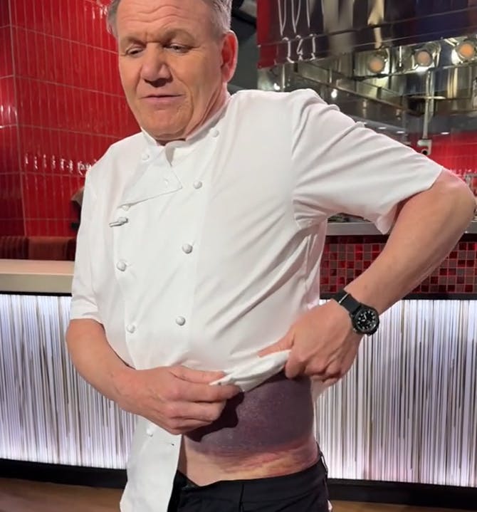 Gordon Ramsay viser sine knubs frem.