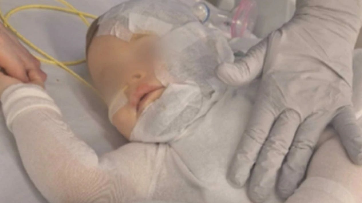 En ni måneder gammel dreng fra Australien er indlagt med voldsomme forbrændinger, efter en ukendt gerningsmand tirsdag hældte skoldhed kaffe ud over ham.