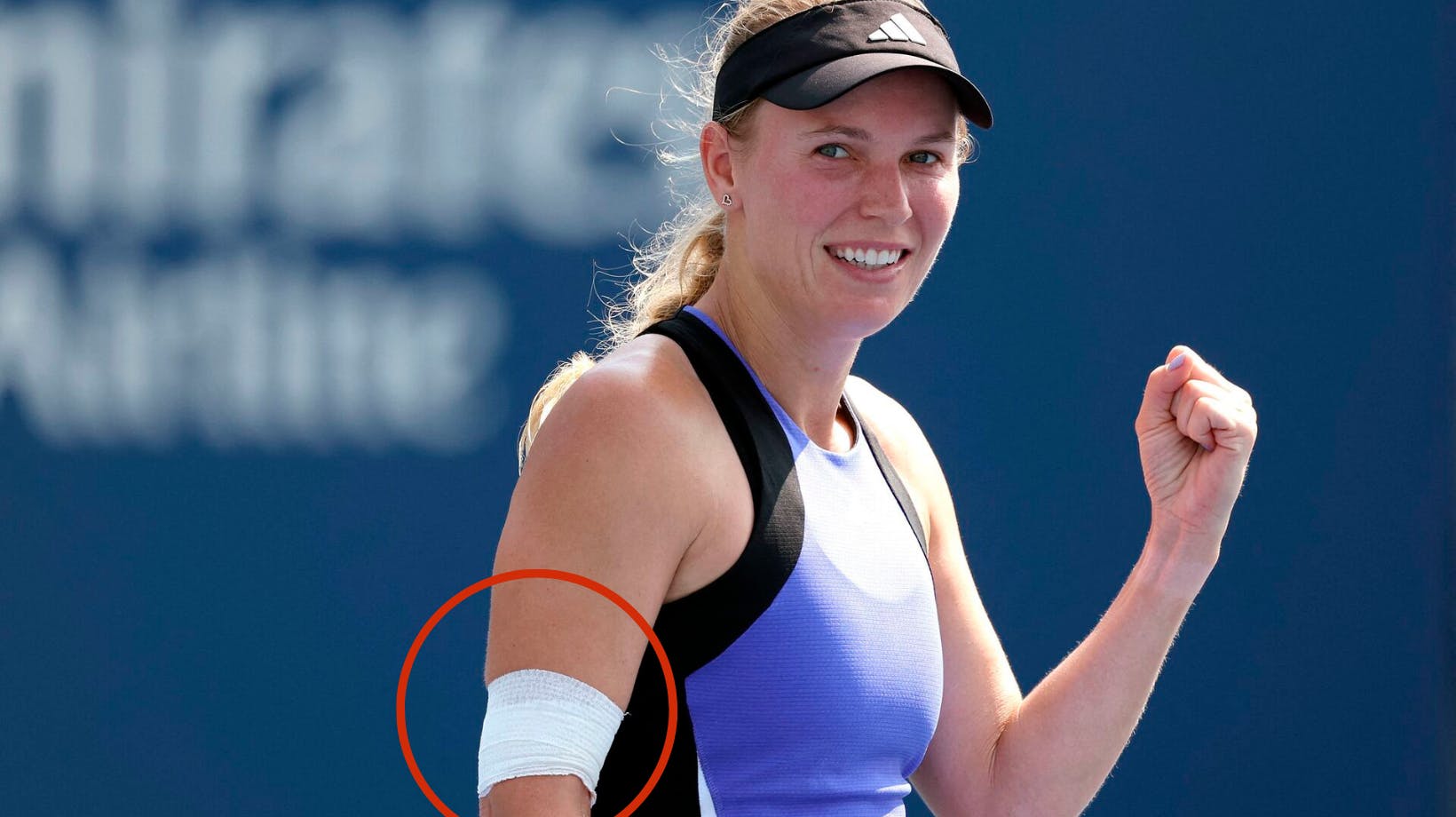 Caroline Wozniacki passer på armen, men det betyder ikke, at hun er stoppet med at spille.