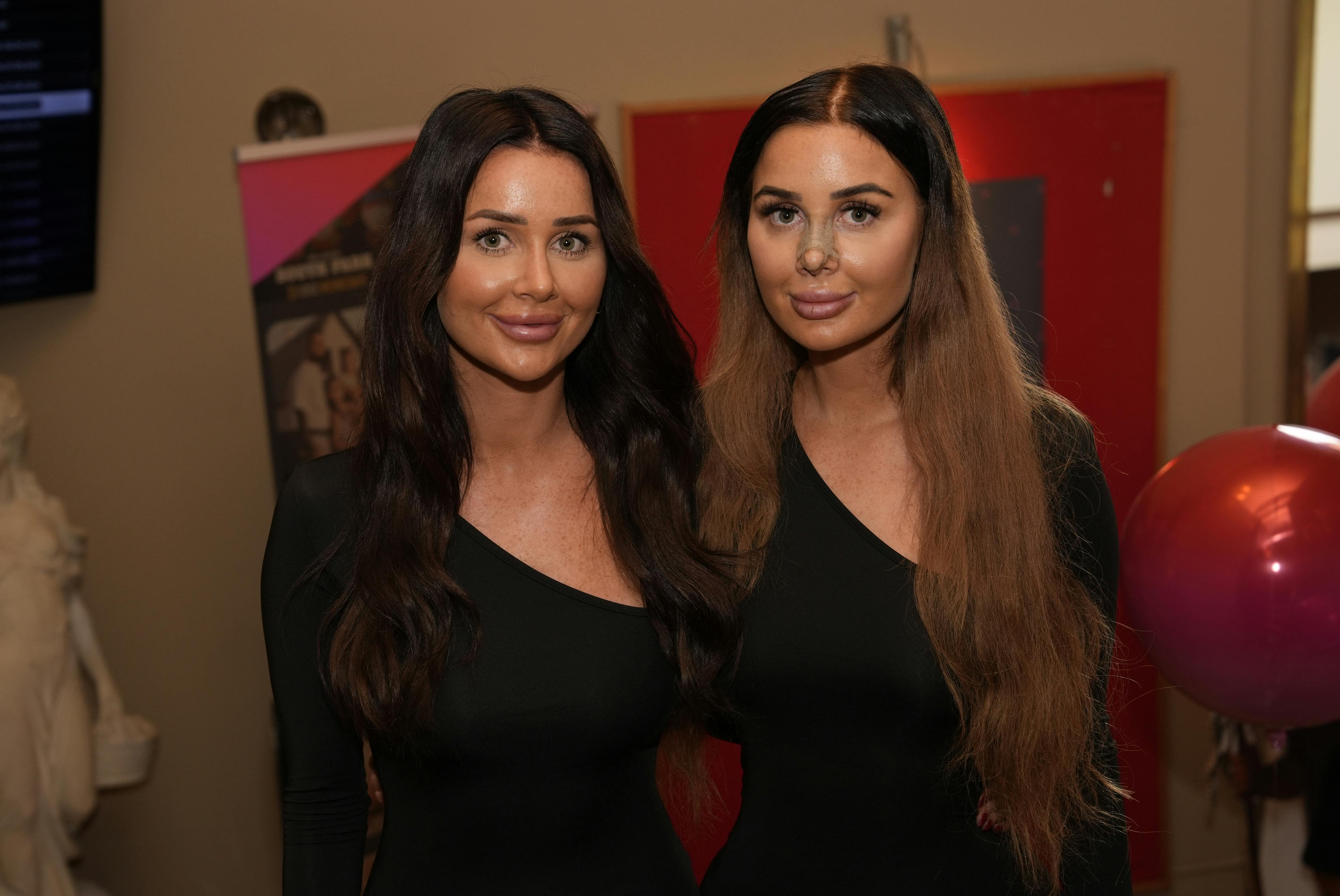 Isabell Bach er tvilling til Vivi Bach fra "Paradise Hotel". Søstrene er lige nu aktuelle i Viaplay-serien "Vivis numse" - men siden optagelserne har paradisoen igen ændret udseende.
