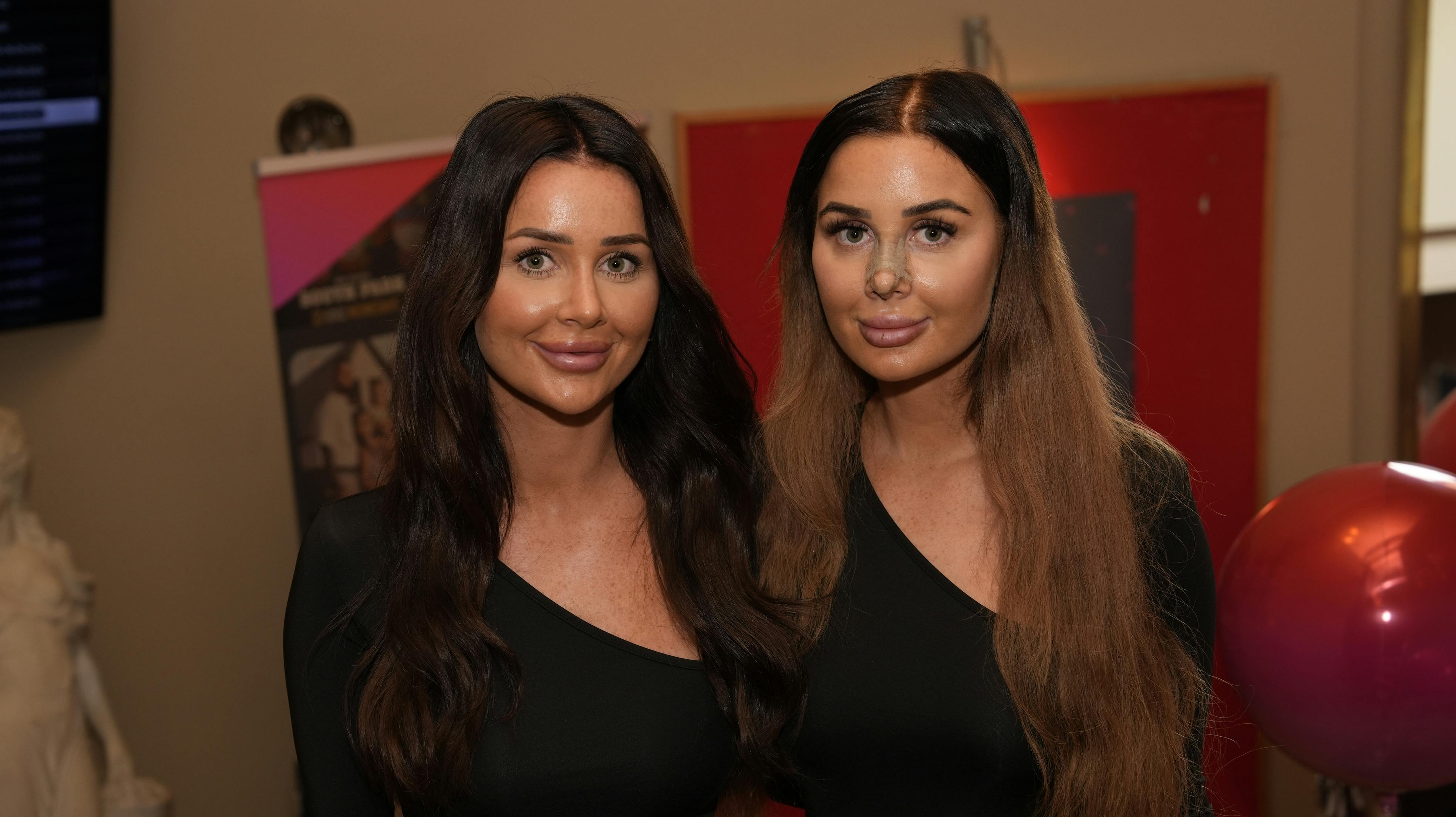 Isabell Bach er tvilling til Vivi Bach fra "Paradise Hotel". Søstrene er lige nu aktuelle i Viaplay-serien "Vivis numse" – men siden optagelserne har paradisoen igen ændret udseende.