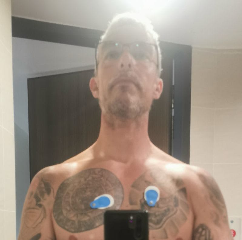 På hospitalet vejede Jesper 82 kilo.